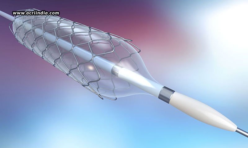 Are-Indian-Stents-At-Par-With-Globally-Available-Variants